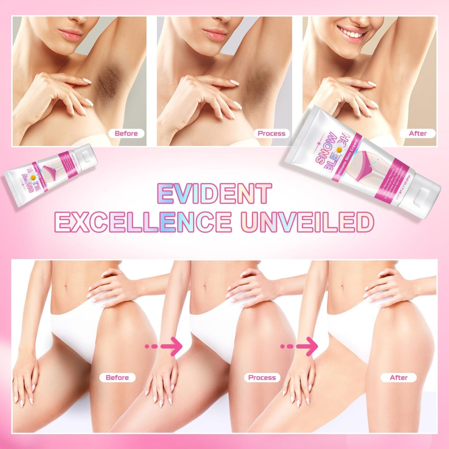 Intim Bleaching Creme - Whitening Cream - Bleichcreme Pigmentflecken Entferner - Aufhellungscreme Für Bikini Skin & Underarm - Snow Wh-i-te Cream mit Vitamin C, Centella Asiatica & Kamille
